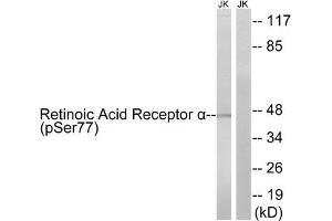 Western blot analysis of extracts from Jurkat cells treated with PMA (125 ng/mL, 30 mins), using Retinoic Acid Receptor α(Phospho-Ser77) antibody. (Retinoic Acid Receptor alpha 抗体  (pSer77))