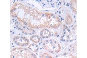 IHC-P analysis of Kidney tissue, with DAB staining. (CXCL12 抗体  (AA 23-89))