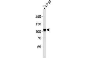 Western Blotting (WB) image for anti-C-Mer Proto-Oncogene Tyrosine Kinase (MERTK) antibody (ABIN3003537) (MERTK 抗体)