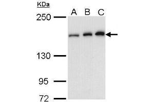 WB Image Sample (30 ug of whole cell lysate) A: A431 , B: H1299 C: Molt-4 , 5% SDS PAGE antibody diluted at 1:1000