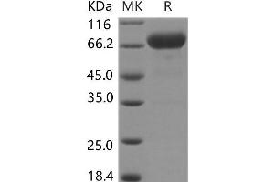 Western Blotting (WB) image for Interleukin 12 (IL12) protein (His tag) (ABIN7317148) (IL12 Protein (His tag))
