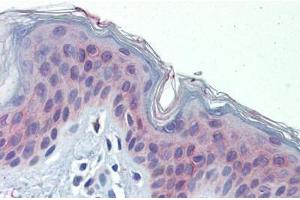 Human Skin (formalin-fixed, paraffin-embedded) stained with POLDIP3 antibody ABIN462229 followed by biotinylated goat anti-rabbit IgG secondary antibody ABIN481713, alkaline phosphatase-streptavidin and chromogen. (POLDIP3 抗体  (AA 326-375))