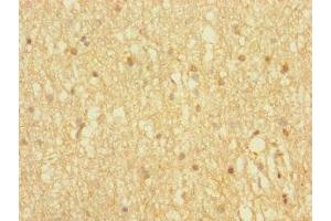 Immunohistochemistry of paraffin-embedded human brain tissue using ABIN7155885 at dilution of 1:100 (HOMER3 抗体  (AA 151-361))