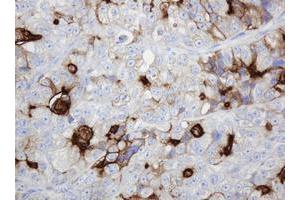 Image no. 7 for anti-ATP-Binding Cassette, Sub-Family B (MDR/TAP), Member 1 (ABCB1) (AA 995-1280) antibody (ABIN1491725)