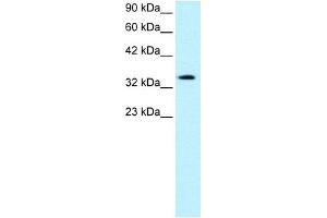 WB Suggested Anti-PAWR Antibody Titration:  0. (PAWR 抗体  (Middle Region))