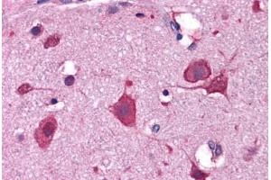 Human Brain, Cortex: Formalin-Fixed, Paraffin-Embedded (FFPE) (IRGC 抗体  (C-Term))