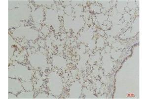 Immunohistochemistry (IHC) analysis of paraffin-embedded Rat LungTissue using Endothelin B ReceptorRabbit Polyclonal Antibody diluted at 1:200.