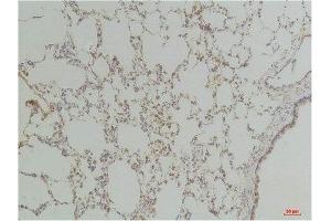 Immunohistochemistry (IHC) analysis of paraffin-embedded Rat LungTissue using Endothelin B ReceptorRabbit Polyclonal Antibody diluted at 1:200. (EDNRB 抗体)