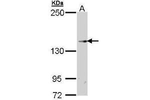 Western Blotting (WB) image for anti-Transient Receptor Potential Cation Channel, Subfamily M, Member 2 (TRPM2) (N-Term) antibody (ABIN2856853)