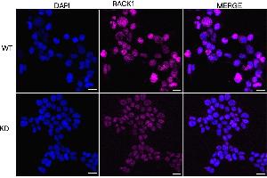 Immunocytochemical staining of HeLa cells using RACK1 antibody (ABIN7798819), 1:1,000), Top panel: wild-type (WT), Bottom panal: RACK1 shRNA knockdown (KD).