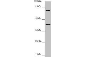 Western blot All lanes: RACGAP1 antibody at 2. (RACGAP1 抗体  (AA 353-632))