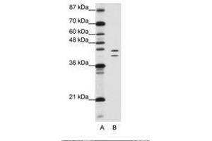Image no. 2 for anti-Heterogeneous Nuclear Ribonucleoprotein D (HNRNPD) (AA 61-110) antibody (ABIN203267) (HNRNPD/AUF1 抗体  (AA 61-110))