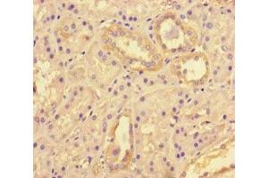 Immunohistochemistry of paraffin-embedded human kidney tissue using ABIN7171500 at dilution of 1:100 (TNKS2 抗体  (AA 1-246))
