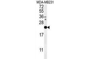 Western Blotting (WB) image for anti-Interleukin 1 Family, Member 6 (IL1F6) antibody (ABIN3002274) (IL36A/IL1F6 抗体)