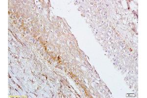 Immunohistochemistry (Paraffin-embedded Sections) (IHC (p)) image for anti-1-Acylglycerol-3-Phosphate O-Acyltransferase 4 (AGPAT4) (AA 231-330) antibody (ABIN708671)
