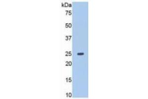 Western Blotting (WB) image for Matrix Metallopeptidase 13 (Collagenase 3) (MMP13) ELISA Kit (ABIN6730863)