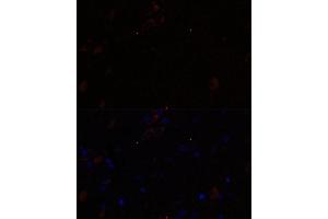 Immunofluorescence analysis of rat brain using KIF17 antibody (ABIN7268123) at dilution of 1:100. (KIF17 抗体  (AA 360-660))