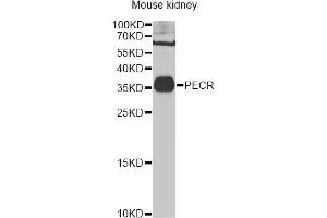 Western blot analysis of extracts of mouse kidney, using PECR Antibody (ABIN2564466) at 1:1000 dilution. (PECR 抗体)