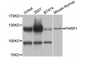 Western blot analysis of extracts of various cell lines, using PARP1 antibody (ABIN5998456) at 1/1000 dilution. (PARP1 抗体)