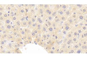 Detection of IGF1 in Mouse Liver Tissue using Polyclonal Antibody to Insulin Like Growth Factor 1 (IGF1) (IGF1 抗体  (AA 49-153))