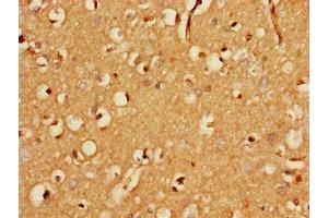 Immunohistochemistry (IHC) image for anti-F-Box Protein 25 (FBXO25) (AA 1-291) antibody (ABIN7152417)