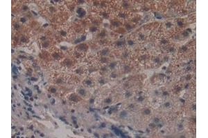 Immunohistochemistry (IHC) image for anti-Peroxisome Proliferator-Activated Receptor alpha (PPARA) (AA 61-170) antibody (ABIN7432904)