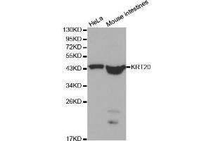 Western blot analysis of extracts of various cell lines, using KRT20 antibody.