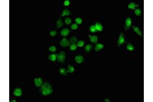 Immunofluorescence staining of PC-3 cells with ABIN7163013 at 1:100, counter-stained with DAPI. (PPARG 抗体  (AA 1-477))