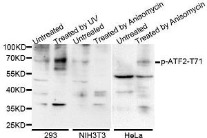 Western blot analysis of extracts of various cells, using Phospho-ATF2-T71 antibody (ABIN5969881). (ATF2 抗体  (pThr53))