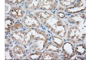 Immunohistochemistry (IHC) image for anti-Sorting Nexin 9 (SNX9) antibody (ABIN1501046)