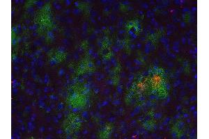 Indirect immunostaining of a PFA fixed formic acid treated brain section from a triple transgenic Alzheimer´s disease mouse with anti-Abeta 40 (dilution 1 : 500; red) and rabbit anti-Abeta (, dilution 1 : 500; green). (Abeta 1-40 抗体)