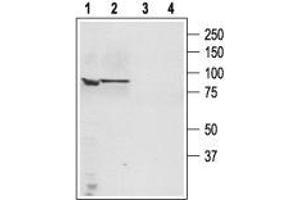 Western blot analysis of human PC3 Caucasian prostate adenocarcinoma (lanes 1 and 3) and human LNCaP prostate carcinoma (lanes 2 and 4) cell lysates: - 1,3. (TRPC4 抗体  (C-Term, Intracellular))
