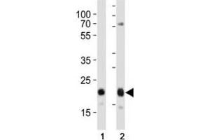 Western blot analysis of lysate from (1) HeLa and (2) MCF-7 cell line using CD9 antibody at 1:1000. (CD9 抗体  (AA 115-145))