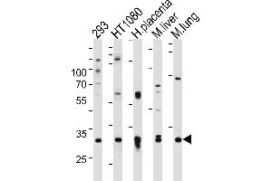 Western blot analysis of lysates from 293,HT1080 cell line,human placenta,mouse liver and lung tissue (from left to right),using SAR1A Antibody . (SAR1A 抗体  (AA 122-149))
