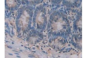 Detection of GP9 in Rat Small intestine Tissue using Polyclonal Antibody to Glycoprotein IX, Platelet (GP9) (CD42a 抗体  (AA 1-189))