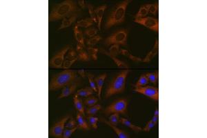 Immunofluorescence analysis of U-2 OS cells using BMP6 Rabbit mAb (ABIN7265900) at dilution of 1:100 (40x lens). (BMP6 抗体)
