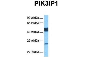 Host:  Rabbit  Target Name:  PIK3IP1  Sample Tissue:  Human Lung Tumor  Antibody Dilution:  1. (PIK3IP1 抗体  (Middle Region))