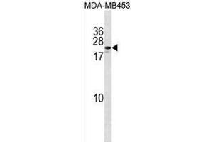 ZN Antibody (Center) (ABIN1538689 and ABIN2850066) western blot analysis in MDA-M cell line lysates (35 μg/lane). (ZNF580 抗体  (AA 91-119))