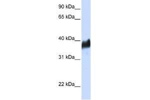 WB Suggested Anti-CLN8 Antibody Titration:  0.