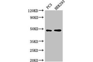 Western Blot Positive WB detected in: PC-3 whole cell lysate, HEK293 whole cell lysate All lanes: ACTR10 antibody at 3 μg/mL Secondary Goat polyclonal to rabbit IgG at 1/50000 dilution Predicted band size: 47 kDa Observed band size: 47 kDa (ACTR1 抗体  (AA 165-417))