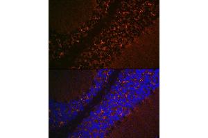 Immunofluorescence (IF) image for anti-Solute Carrier Family 17 (Vesicular Glutamate Transporter), Member 6 (SLC17A6) (C-Term) antibody (ABIN7270407)
