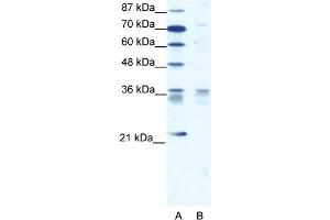 WB Suggested Anti-BARX1 Antibody   Titration: 1. (BARX1 抗体  (Middle Region))