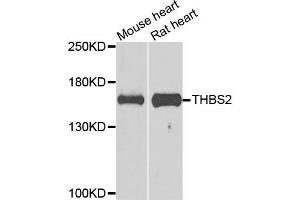 Western blot analysis of extracts of various cell lines, using THBS2 antibody. (Thrombospondin 2 抗体)