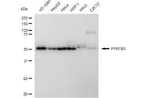 Western blotting analysis using PFKFB3 antibody (ABIN7797431).