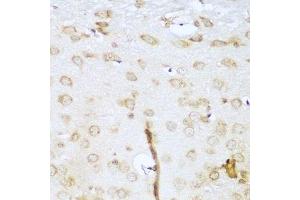 Immunohistochemistry of paraffin-embedded mouse brain using UBE2L3 antibody.