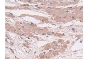 Detection of TAGLN in Human Prostate Tissue using Polyclonal Antibody to Transgelin (TAGLN) (Transgelin 抗体  (AA 1-201))