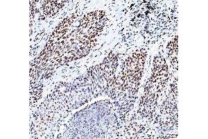 IHC analysis of HDAC2 using anti-HDAC2 antibody (ABIN7601564). (HDAC2 抗体  (AA 387-488))