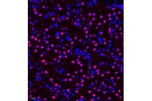 Immunofluorescence of paraffin embedded mouse kidney using ZHX3 (ABIN7076287) at dilution of 1:650 (400x lens) (ZHX3 抗体)