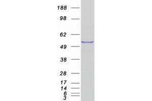 Western Blotting (WB) image for Cytochrome P450, Family 1, Subfamily A, Polypeptide 1 (CYP1A1) protein (Myc-DYKDDDDK Tag) (ABIN2712753)