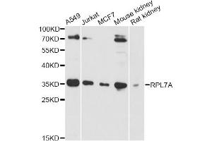 Western blot analysis of extracts of various cell lines, using RPL7A antibody (ABIN6290895) at 1:3000 dilution. (RPL7A 抗体)